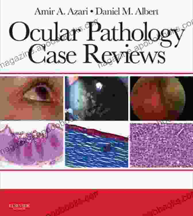 Ocular Pathology Book Cover Ocular Pathology Sean Neill