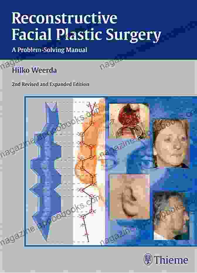 Reconstructive Facial Plastic Surgery Problem Solving Manual Reconstructive Facial Plastic Surgery: A Problem Solving Manual