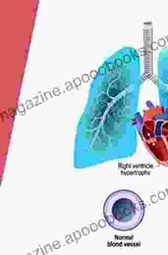 Treatment Of Pulmonary Hypertension (Current Cardiovascular Therapy)