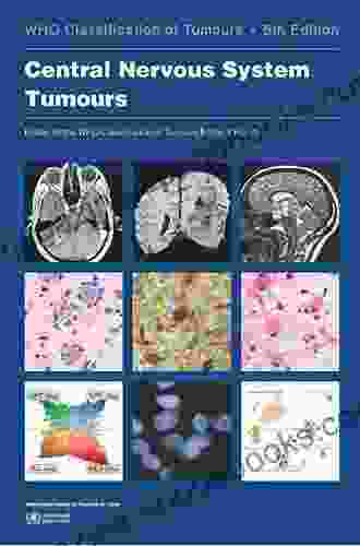 Tumors Of The Central Nervous System Volume 14: Glioma Meningioma Neuroblastoma And Spinal Tumors