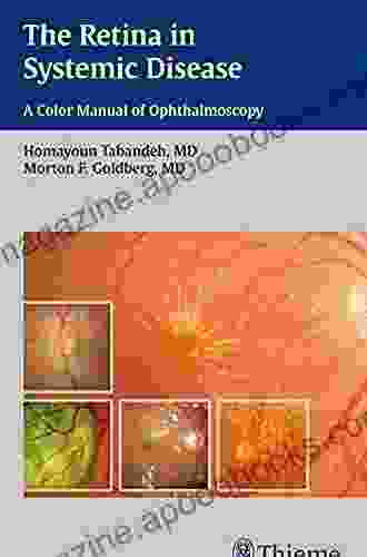 The Retina In Systemic Disease: A Color Manual Of Ophthalmoscopy